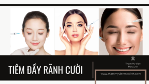 Tiêm Đầy rãnh cười