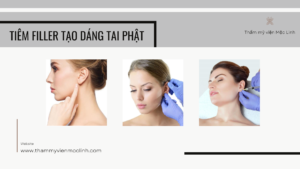 Tiêm Filler tạo dáng tai Phật