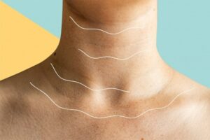 Da cổ bị thâm đen: Nguyên nhân và 10+ cách trị thâm cổ hiệu quả