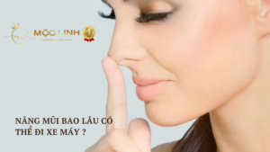 Nâng mũi bao lâu có thể đi xe máy ?