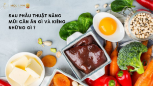 Sau phẫu thuật nâng mũi cần ăn gì và kiêng những gì ?