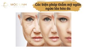 Các biện pháp thẩm mỹ ngăn ngừa lão hóa da