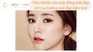 Tiêu chuẩn của một dáng mũi đẹp và 5 xu hướng mũi đẹp hiện nay