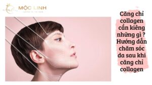 Căng chỉ collagen cần kiêng những gì ? Hướng dẫn chăm sóc da sau khi căng chỉ collagen