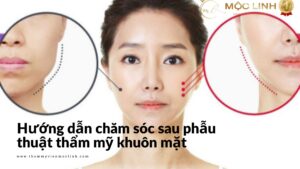 Hướng dẫn chăm sóc sau phẫu thuật thẩm mỹ khuôn mặt